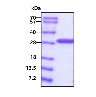 SDS-PAGE: Recombinant Human ETHE1 His Protein [NBP1-78881]